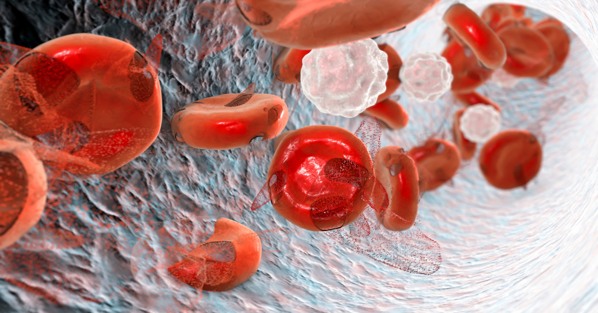 Anemia (1).png